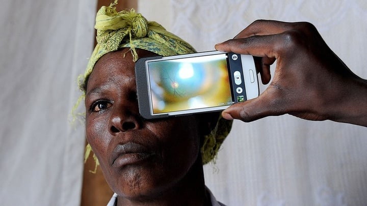 Kenya-Eye-Scanner