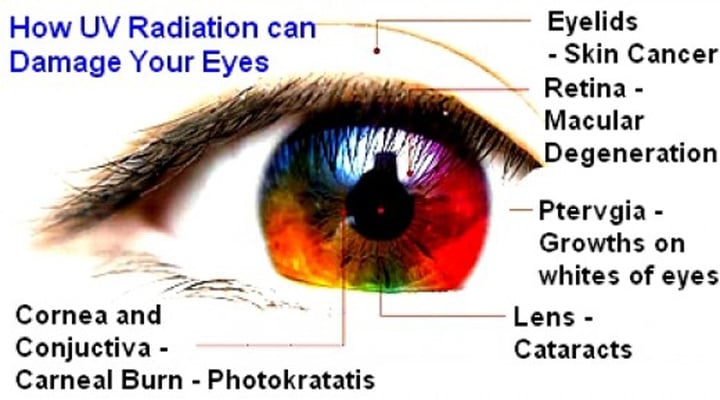 UV_Damage_To_Eyes