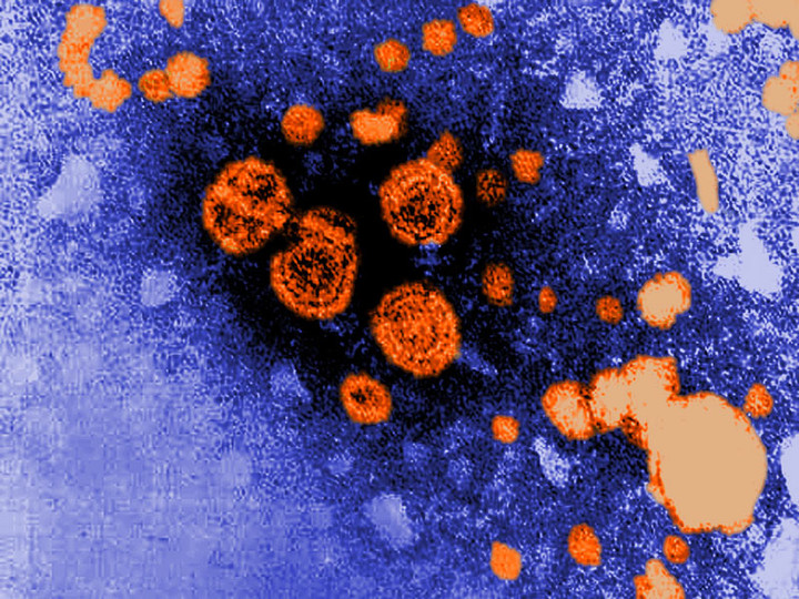 cdc_150302_hepatitis_b_800x600