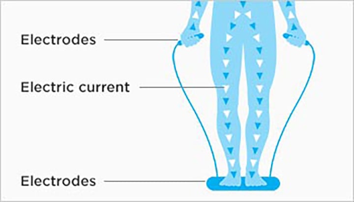 bia-explained-1