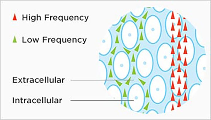 bia-explained-2