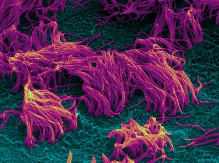 scanning-electromicrograph-of-ciliated-bronchiolar-epithelium-in-small-airway-on-a-chip