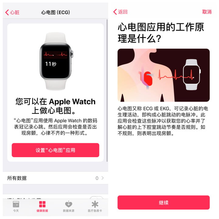 能救命還是噱頭？ Apple Watch ECG 心電圖功能實測 - 電腦王阿達