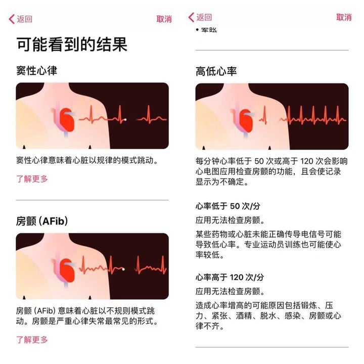 能救命還是噱頭？ Apple Watch ECG 心電圖功能實測 - 電腦王阿達