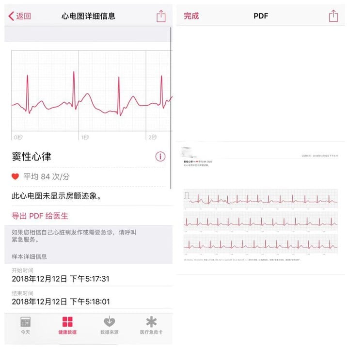 能救命還是噱頭？ Apple Watch ECG 心電圖功能實測 - 電腦王阿達