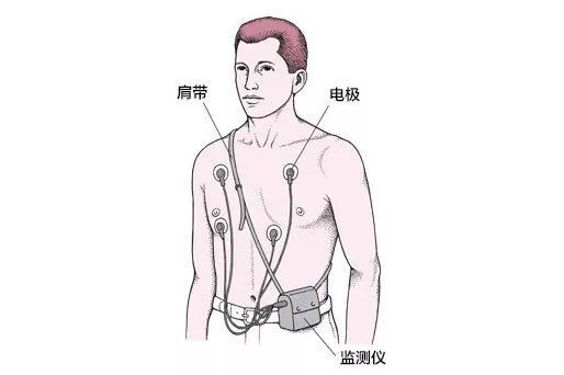  只要一个 「手表」，就能自己在家测心电图？靠谱吗？