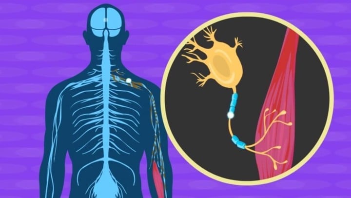 0324brainimplantALS-2-1024x578.jpg!720