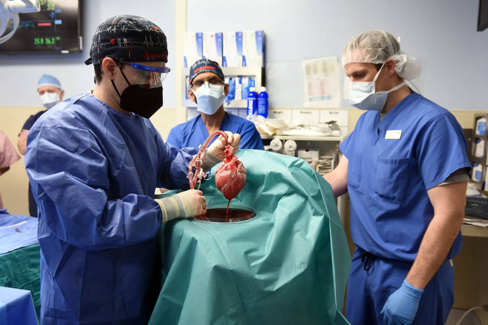 nytimes - Muore il primo paziente al mondo con trapianto di cuore di maiale, grazie per averci fatto vedere la speranza del “cambiamento del cuore di maiale”