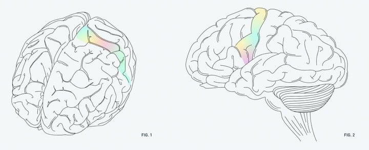 0506Neuralinktinnitus-7-1024x418.jpg!720