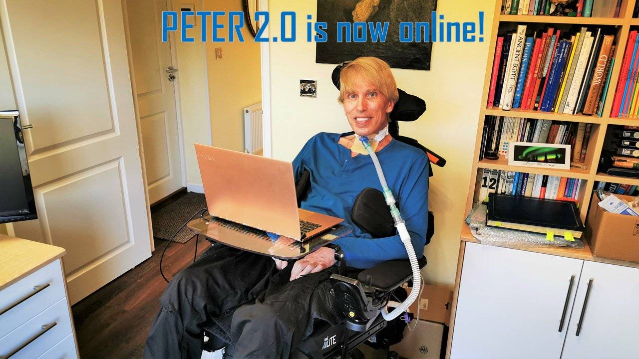Auf Wiedersehen Peter 2.0! Der erste echte Cyborg der Welt wird für tot erklärt - EJGqo5GWkAAHk Z
